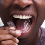 invisalign treatment, advantages of invisalign, orthodontics, braces, clear aligners, straighten teeth, smile